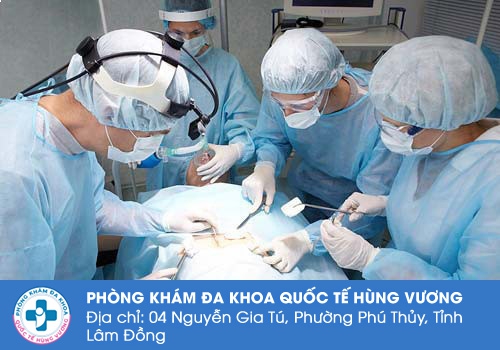 Chi phí phẫu thuật trĩ phụ thuộc vào nhiều yếu tố khác nhau.