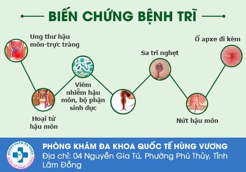 Những biến chứng nguy hiểm của bệnh trĩ.