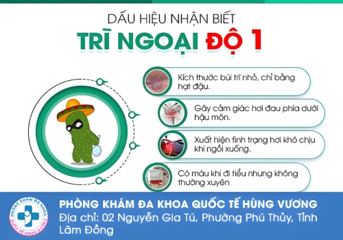 Dấu hiệu bệnh trĩ độ 1.