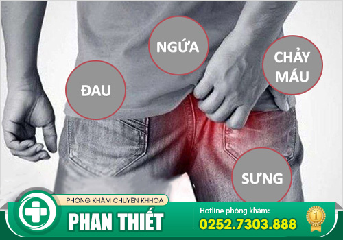 Những bệnh hậu môn cần xoá sổ ra khỏi cơ thể