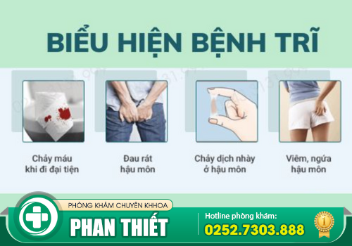 Triệu chứng của bệnh trĩ