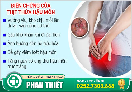 Cắt thịt thừa ở hậu môn bằng phương pháp nào hiệu quả?