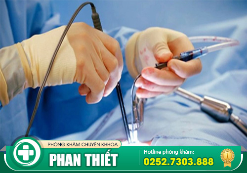 Các phương pháp cắt trĩ mới đang được nhiều bệnh viện, phòng khám áp dụng