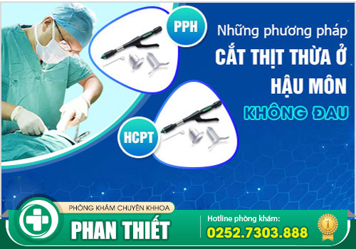 Có nên cắt da thừa hậu môn không?