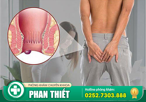 Cắt thịt thừa ở hậu môn bằng phương pháp nào hiệu quả?