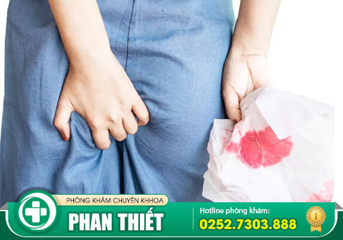 Đi Cầu Ra Máu Là Bệnh Gì? Phương Pháp Điều Trị Khi Bị Đi Cầu Ra Máu