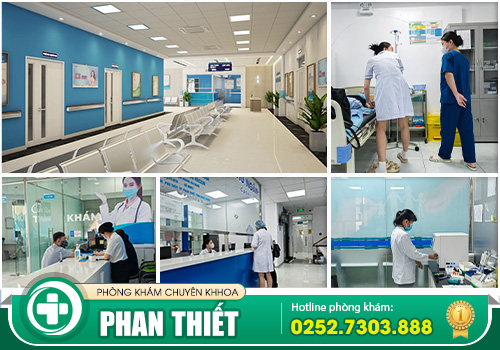 Nguyên nhân bệnh mạch lươn - Triệu chứng và phương pháp hỗ trợ điều trị