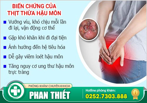 Điều trị thịt dư ở hậu môn bằng cách nào?