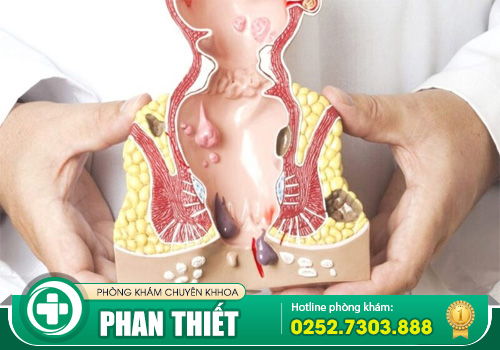 Kiểm tra hậu môn - Phát hiện sớm các bệnh liên quan tới trực tràng hậu môn