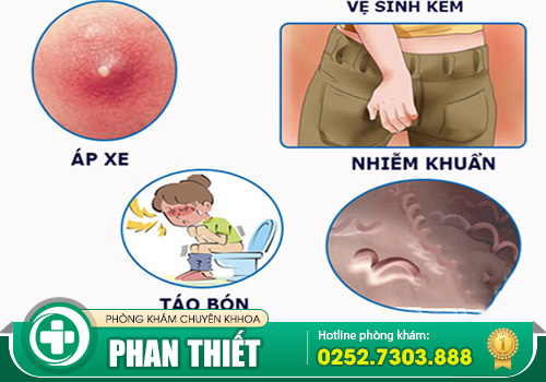 Nguyên nhân bệnh mạch lươn - Triệu chứng và phương pháp hỗ trợ điều trị