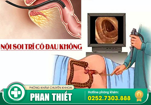 Nội soi trĩ không đau được thực hiện như thế nào?