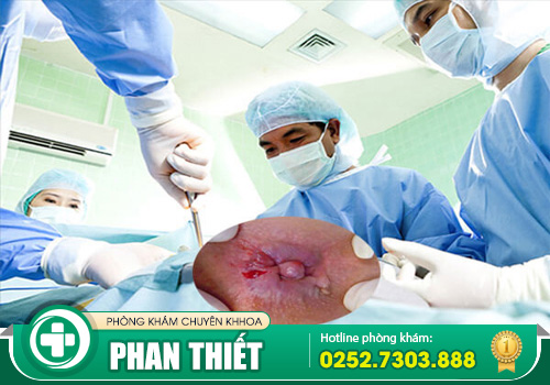 Nội soi trĩ không đau được thực hiện như thế nào?