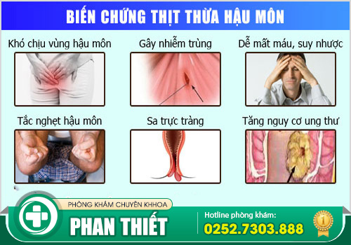 Có cục thịt dư hậu môn có phải bệnh trĩ không?