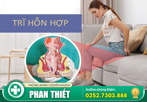 Hiểu về bệnh trĩ hỗn hợp: dấu hiệu nhận biết và cách điều trị