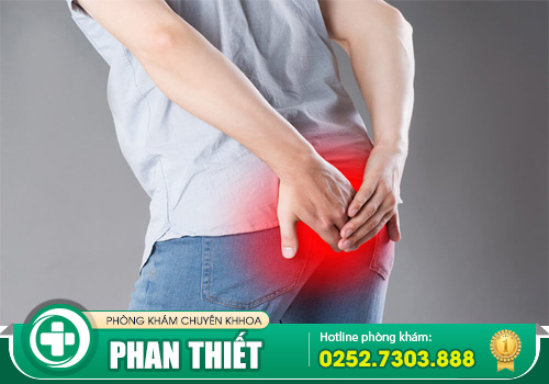 Viêm hậu môn không đơn giản là viêm nhiễm thông thường